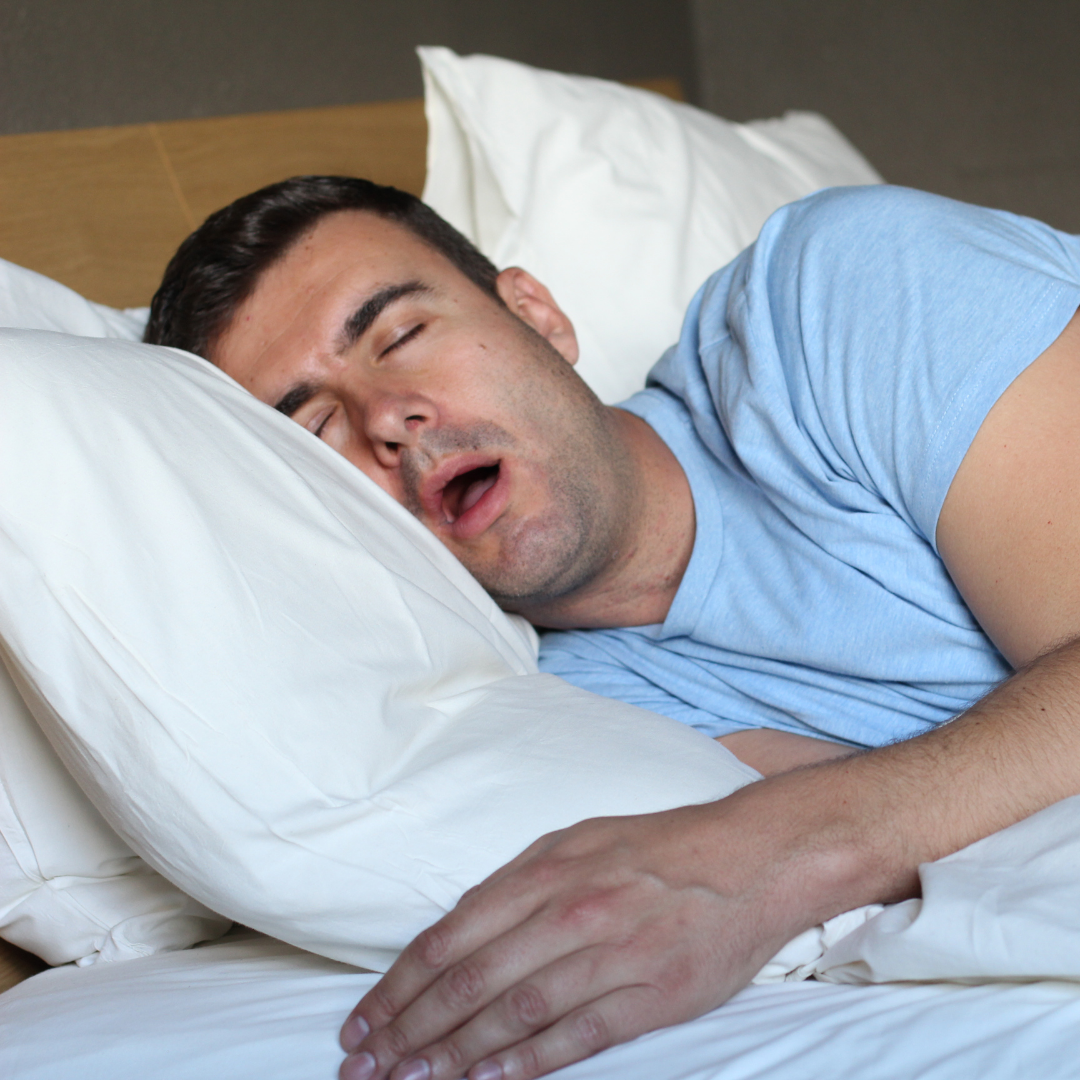 Man asleep on his side with mouth open, appearing to snore on white pillows in a bedroom